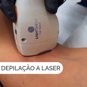 Procedimento de depilação a laser para eliminação definitiva dos pelos.