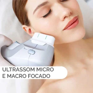 Aplicação de ultrassom focado para estimular colágeno e melhorar o contorno facial.